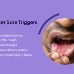 Why Canker Sores Treatments Matter For Teenagers